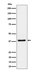Western blot analysis of UCHL5IP expression in Jurkat cell lysate.