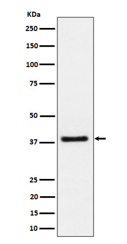 Western blot analysis of UCHL5IP expression in Jurkat cell lysate.