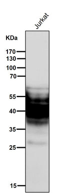 All lanes use the Antibody at 1:3K dilution for 1 hour at room temperature.