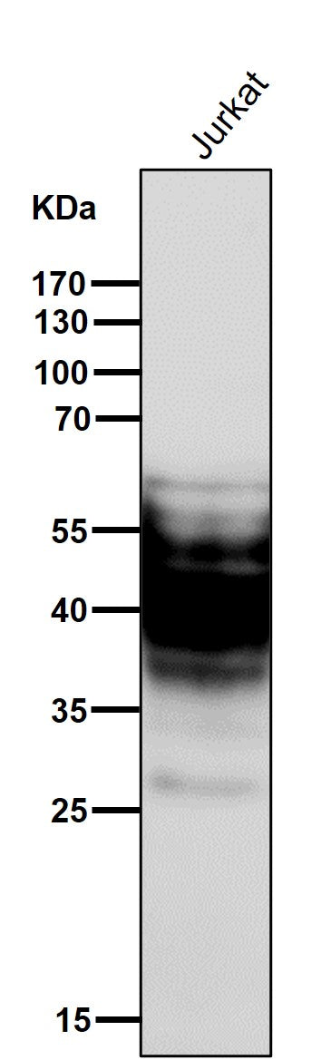 All lanes use the Antibody at 1:3K dilution for 1 hour at room temperature.