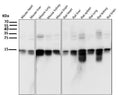 All lanes use the Antibody at 1:5K dilution for 1 hour at room temperature.