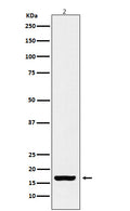 Western blot analysis of Histone H3 (acetyl K18) expression in HeLa cell treated with TSA cell lysate.