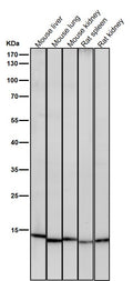 All lanes use the Antibody at 1:1K dilution for 1 hour at room temperature.