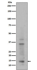 Western blot analysis of Histone H3 (mono+di+tri methyl K14) expression in HeLa cell lysate.