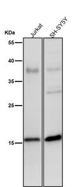 All lanes use the Antibody at 1:2K dilution for 1 hour at room temperature.