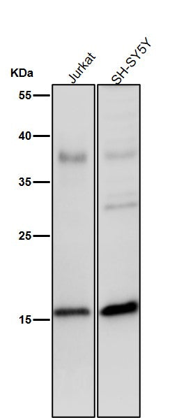 All lanes use the Antibody at 1:2K dilution for 1 hour at room temperature.