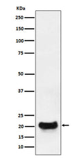 Western blot analysis of DCTN5 expression in MCF7 cell lysate.