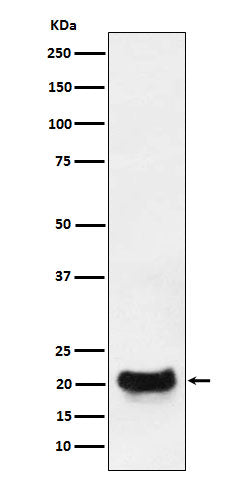 Western blot analysis of DCTN5 expression in MCF7 cell lysate.