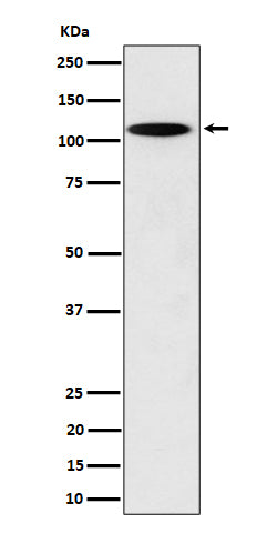 Western blot analysis of N4BP1 expression in PC12 cell lysate.