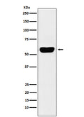 Western blot analysis of Salivary alpha amylase expression in Human pancreas lysate.