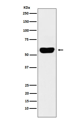 Western blot analysis of Salivary alpha amylase expression in Human pancreas lysate.