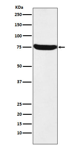 Western blot analysis of HTF9C expression in A431 cell lysate.