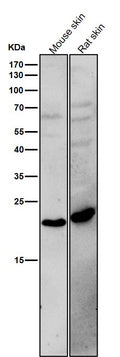 All lanes use the Antibody at 1:1K dilution for 1 hour at room temperature.
