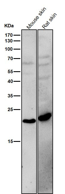 All lanes use the Antibody at 1:1K dilution for 1 hour at room temperature.