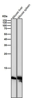 All lanes use the Antibody at 1:1K dilution for 1 hour at room temperature.