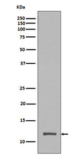 Western blot analysis of Histone H4 (tri methyl K20) expression in HeLa cell lysate.