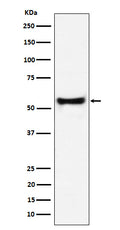 Western blot analysis of PDCD7 expression in Jurkat cell lysate.