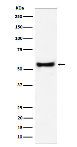 Western blot analysis of PDCD7 expression in Jurkat cell lysate.