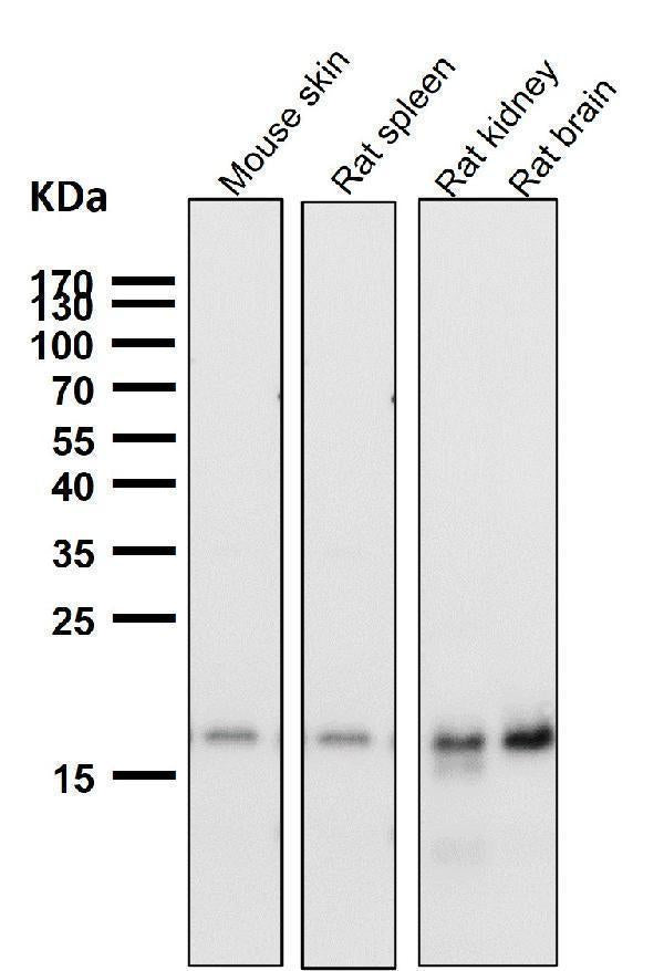 All lanes use the Antibody at 1:2K dilution for 1 hour at room temperature.