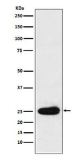 Western blot analysis of Kappa light chain expression in Human plasma cell lysate.