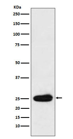 Western blot analysis of Kappa light chain expression in Human plasma cell lysate.