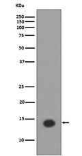 Western blot analysis of Histone H2A (acetyl K9) expression in  HeLa cell lysate treated Trichostatin A.