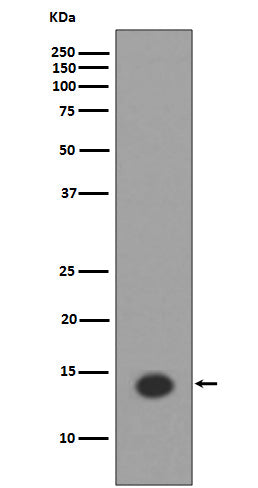 Western blot analysis of Histone H2A (acetyl K9) expression in  HeLa cell lysate treated Trichostatin A.