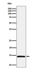 Western blot analysis of Histone H2A (mono methyl K118) expression in HeLa cell lysate.