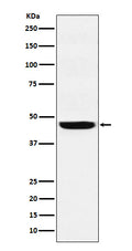 Western blot analysis of SEC61A expression in A431 cell lysate.