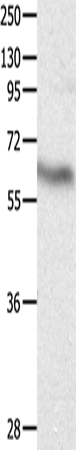 CRMP3 Polyclonal Antibody – Figure 1 of 2