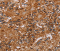 JAKMIP2 Polyclonal Antibody – Figure 1 of 2