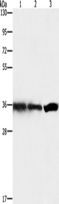 GNB1 Polyclonal Antibody – Figure 1 of 2