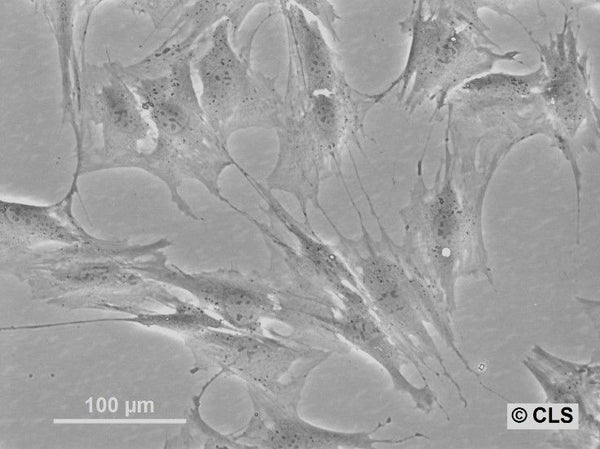 M2-10B4 cell