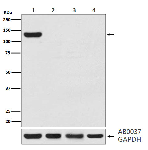 Western blot analysis of CRISPR-Cas9 SA expression in (1) 293T cell lysate transfected with CRISPR-Cas9 SA; (2) 293T cell lysate; (3) 3T3 cell lysate; (4) PC12 cell lysate.