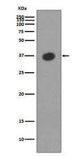 Western blot analysis of MBP expression in Escherichia coli  lysate.