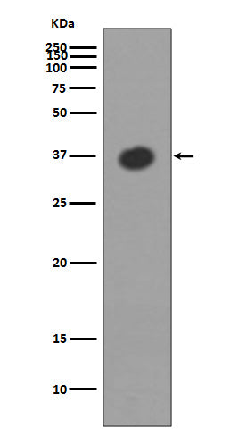 Western blot analysis of MBP expression in Escherichia coli  lysate.