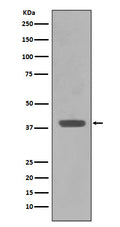 Western blot analysis of Maltose Binding Protein expression in E.coli lysate.