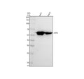 Anti-Cytokeratin 6 Rabbit Monoclonal Antibody