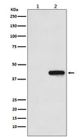 Western blot analysis of His-tagged protein expression in (1) 293T cell lysate; (2) 293T cell transfected with His-tagged protein lysate.