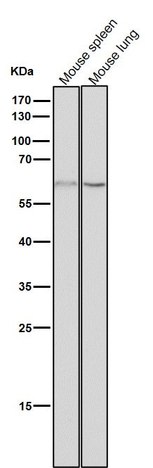 All lanes use the Antibody at 1:3K dilution for 1 hour at room temperature.