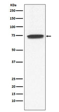 Western blot analysis of GCYA3 expression in Human fetal kidney lysate.