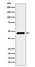 Western blot analysis of CECR5 expression in HepG2 cell lysate.