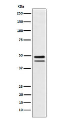 Western blot analysis of Brachyury expression in MUG-Chor1 (human sacral bone chordoma) cell lysate.