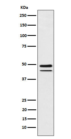 Western blot analysis of Brachyury expression in MUG-Chor1 (human sacral bone chordoma) cell lysate.