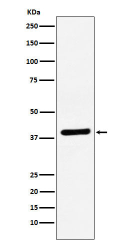 Western blot analysis of VEGFD expression in Caco-2 cell lysate.