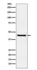 Western blot analysis of Septin 2 expression in Jurkat cell lysate.