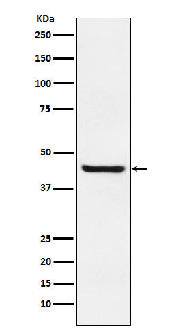 Western blot analysis of Septin 2 expression in Jurkat cell lysate.