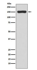 Anti-RNA polymerase beta Rabbit Monoclonal Antibody