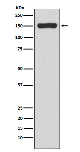 Anti-RNA polymerase beta Rabbit Monoclonal Antibody