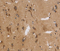 ITPR3 Polyclonal Antibody – Figure 1 of 3